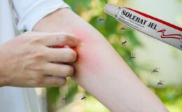 Solerat jel nedir ve Solerat jel ne için kullanılır? Solerat jel  fiyatı 2024